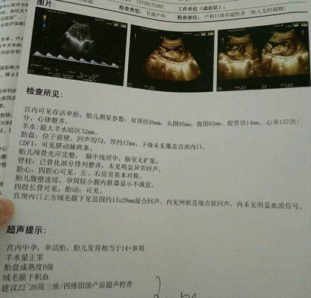 三代试管婴儿限制的关键因素分析与合肥的助孕选择