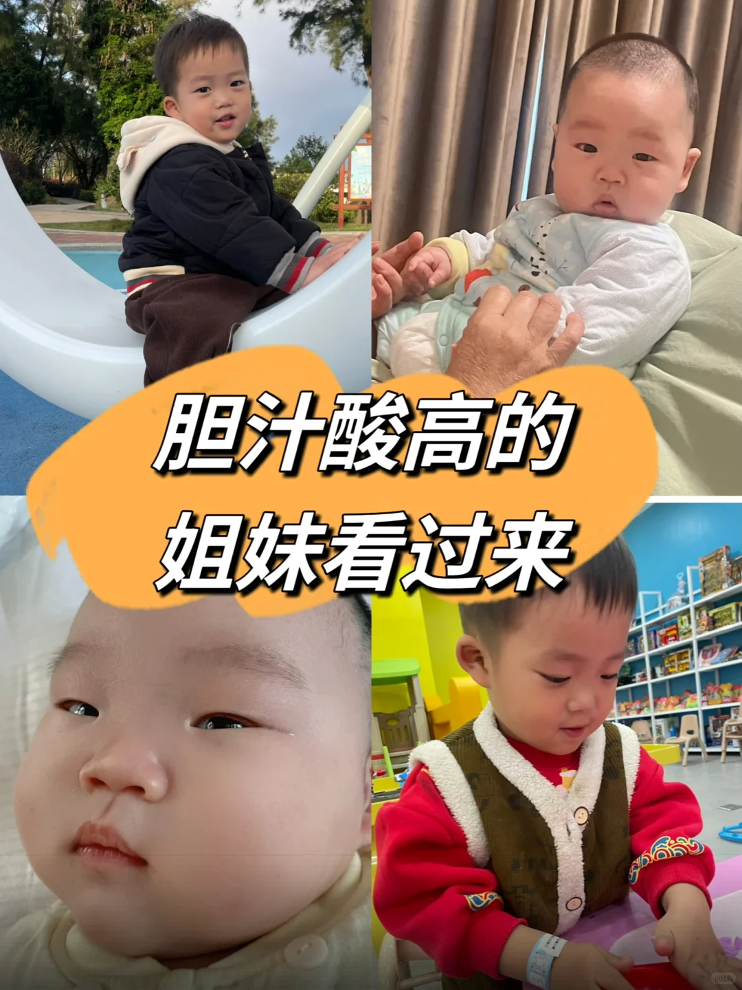 孕期姐妹请留意：第三代试管助孕过程中的胆汁酸异常与应对