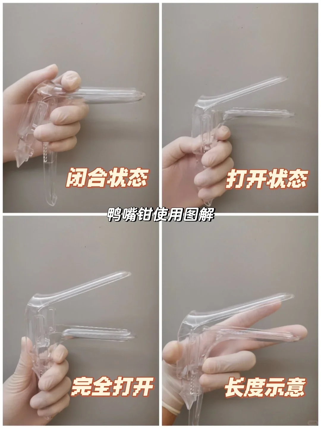 关于鸭嘴钳的独到见解与辅助生殖的选择